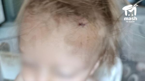 Родственница симферопольского миллионера Иосифа Файнгольда на электросамокате въехала в коляску с ребёнком